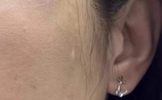 天淳堂9号陈艾条